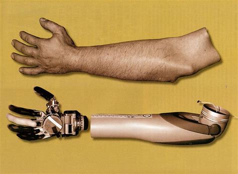 Bionic Arm 2.0, created by an international team led by the Johns ...