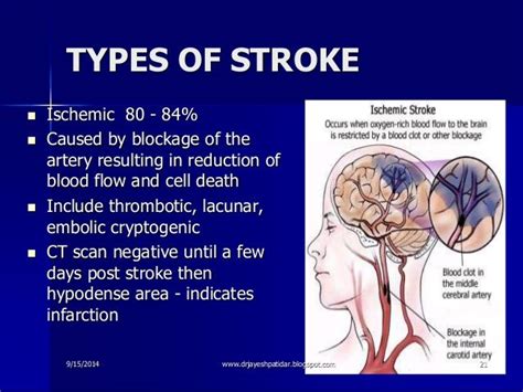 Image result for cerebrovascular accident | Cerebrovascular accident, Nclex, Arteries