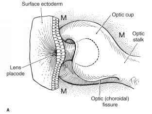 Optic Vesicle And Optic Cup - Ocular Motor - GUWS Medical