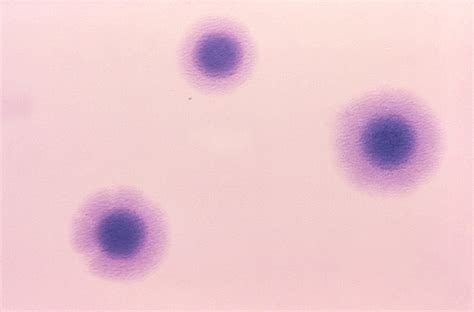 Public Domain Picture | This photograph depicts a number of Gram-negative Mycoplasma hominis ...