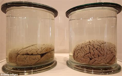 Albert Einsteins Brain In Jar