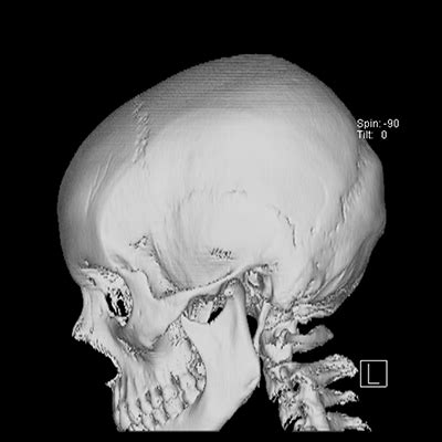 diagnostic-imaging-cat-scan-skullSpin - South Florida Diagnostic Imaging