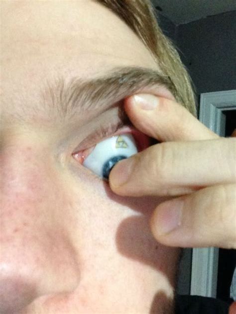 The Making of an Eye Prosthesis (11 pics)