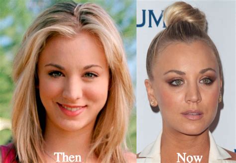 Kaley Cuoco’s Transformation: Plastic Surgery Rumors | Justinboey