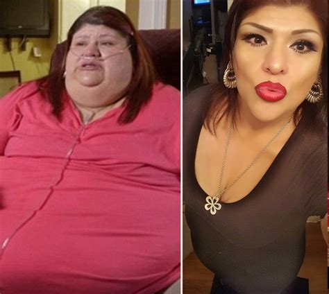 'My 600-Lb Life' Before and After Photos — Where Are They Now?