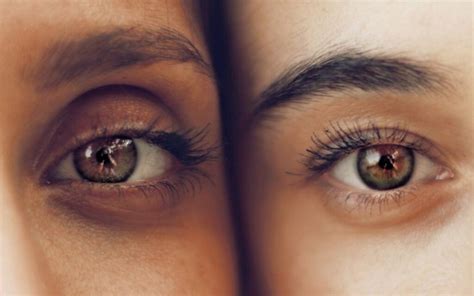 5 Common Signs of Aging Eyes & What To Do About Them - Inner Glow AestheticsMD in Avon, CT