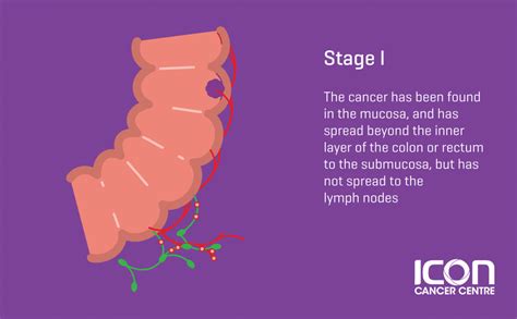 Colorectal Cancer Signs & Symtomps | Icon Centre Singapore