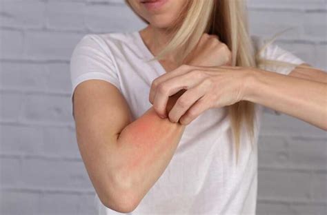 Aloe Vera Allergy: Symptoms, Causes and Management