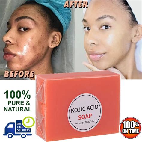 Kojic Acid Soap Before After