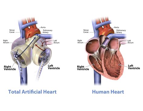 Alternatives To Xenotransplantation | Xenotransplantation