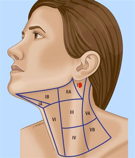 Knot under earlobe? : r/TMJ