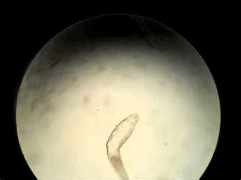 Demodectic Mange under the Microscope - YouTube