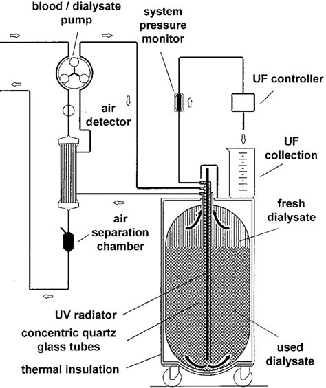 Schematics of dialysis machine. | Download Scientific Diagram