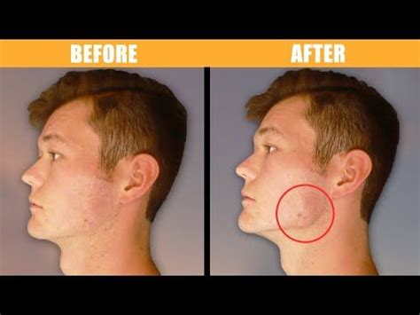 EXERCISES and POSTURE for Defined Jawline (4 Easy Steps) | Jawline, Jawline exercise, Chiseled ...