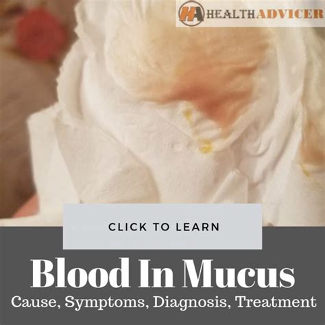 Blood In Mucus: Causes, Picture, Symptoms And Treatment