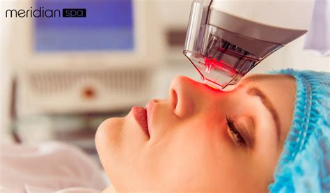 Why to Choose Laser Treatment for Facial Wellness?