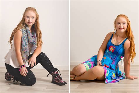 A Teen With Down Syndrome Just Landed A Modelling Contract | Bored Panda