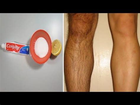 How To Remove Leg Hair Permanently - YouTube | Remove body hair ...