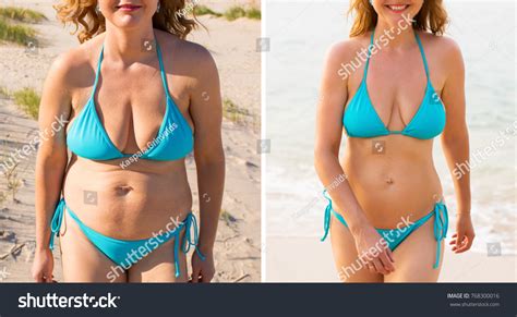 Before After Weight Loss Stock Photo 768300016 | Shutterstock