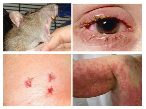 Rat bite - what it looks like, what is dangerous and what to do if a ...