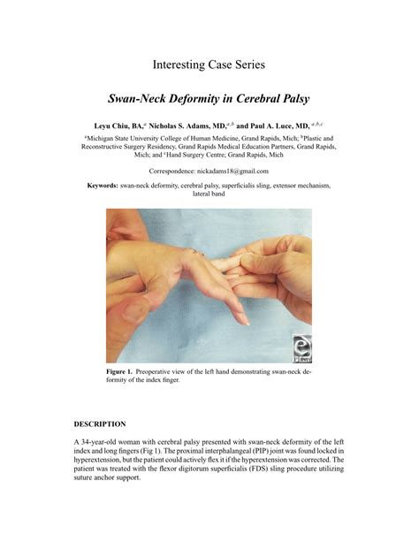 (PDF) Swan-Neck Deformity in Cerebral Palsy