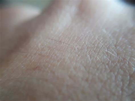 Texture of the Skin.Dark Skin of Woman Hand Macro. Human Skin Texture Stock Image - Image of ...