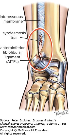 Ankle Syndesmosis Anatomy - Anatomy Reading Source