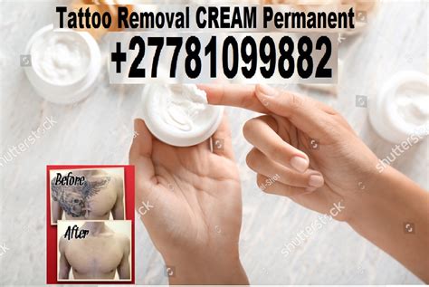 TATTOO REMOVAL CREAM (2) – Alltheweb- Buy and Sell for free anywhere in ...