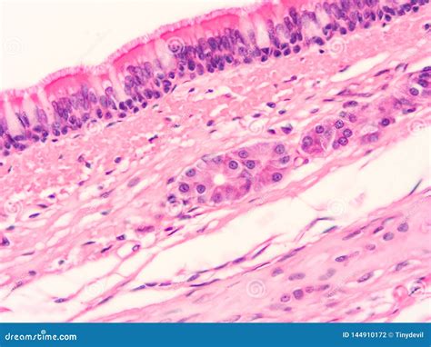 Histologia Do Tecido Humano Da Traqueia Foto de Stock - Imagem de conexivo, fisiologia: 144910172