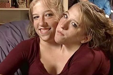 Flipboard: “One body, two souls.” The incredible lives of conjoined twins Abby and Brittany Hensel.