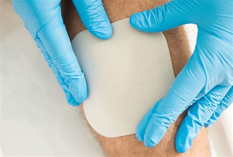 Hydrocolloid Wound Dressings | Benefits And Applications | Wound Care