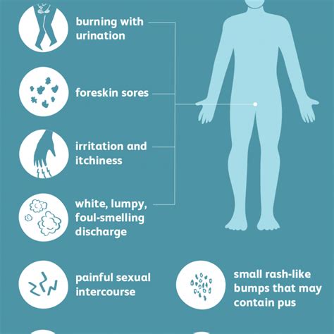 causes of yeast infection - causes of yeast infection