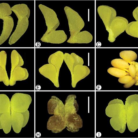 Left to right: dorsal sepal, petal, lateral sepal. A–C, Lateral sepals... | Download Scientific ...