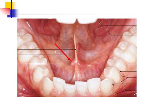 Wharton's Duct | Food, Oral cavity, Cavities