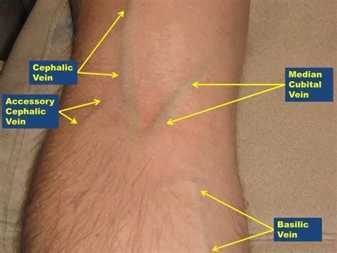 36 diagram of veins in arm for phlebotomy - Diagram For You