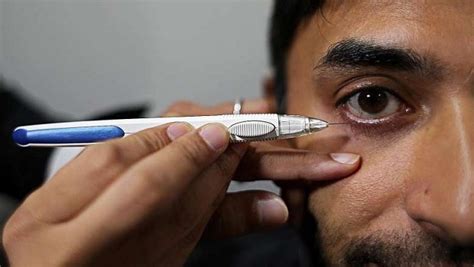 Glaucoma eye drops | SingHealth