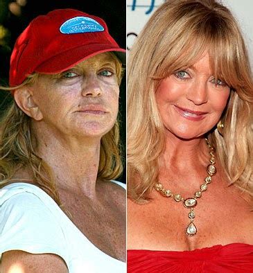 Has Goldie Hawn had Plastic Surgery Gone Wrong Before and After Images