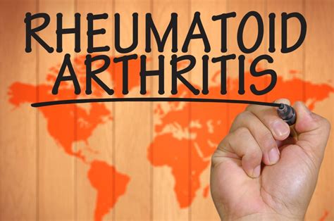 Understanding Arthritis: What Sets Rheumatoid Arthritis Apart from Osteoarthritis? - Overlake ...