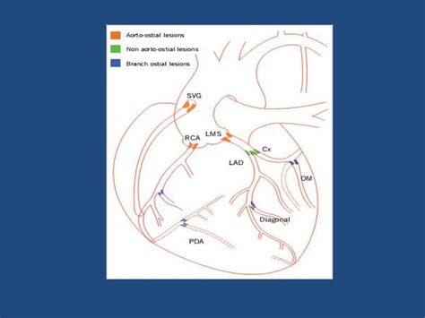 Coronary Ostial stenting techniques:Current status