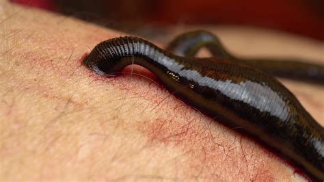 Discouraging leeches from beach area - Cottage Life