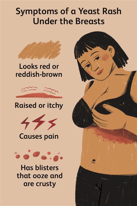 Rash Under Breast: Causes, Treatment, And Prevention, 49% OFF