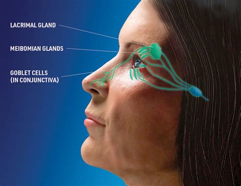 MillennialEYE | The Modern State of Dry Eye: Part 1 Challenges of Managing Dry Eye Disease ...