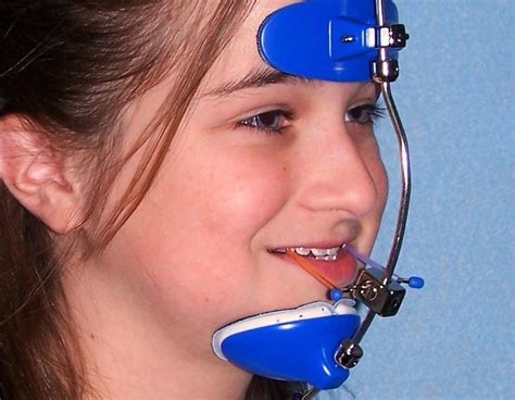 Headgear Braces- Different Types of Orthodontic Headgear