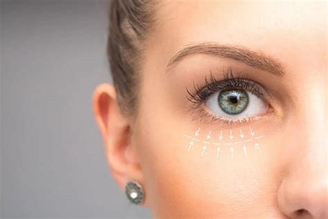 Non-Surgical Eye Bag Removal in Singapore: What You Need to Know - Quality Health Care - Healthy ...