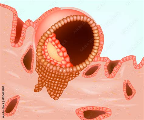 The diagram shows an implanted embryo. Implantation and placentation ...