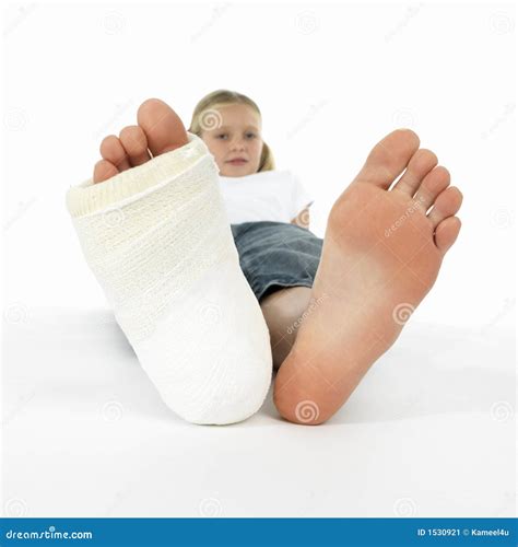 Girl With A Broken Leg Royalty-Free Stock Photo | CartoonDealer.com #1530921