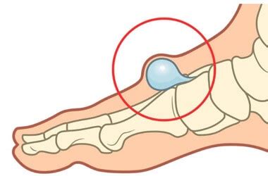 What Is The Bone On Top Of Your Foot Called Online | emergencydentistry.com