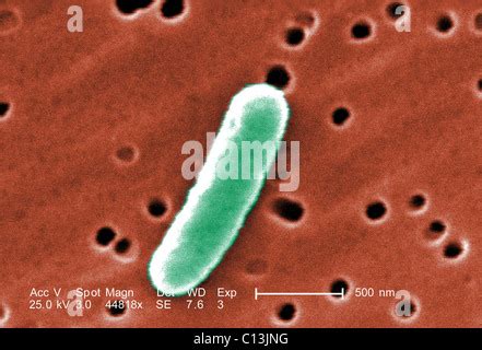 E. coli, a common cause of bacterial diarrhea. Colorized scanning electron micrograph (SEM ...