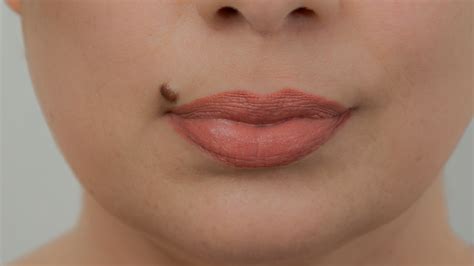 What Does Mole In Lips Mean | Lipstutorial.org