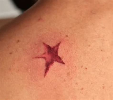 joestar birthmark tattoo